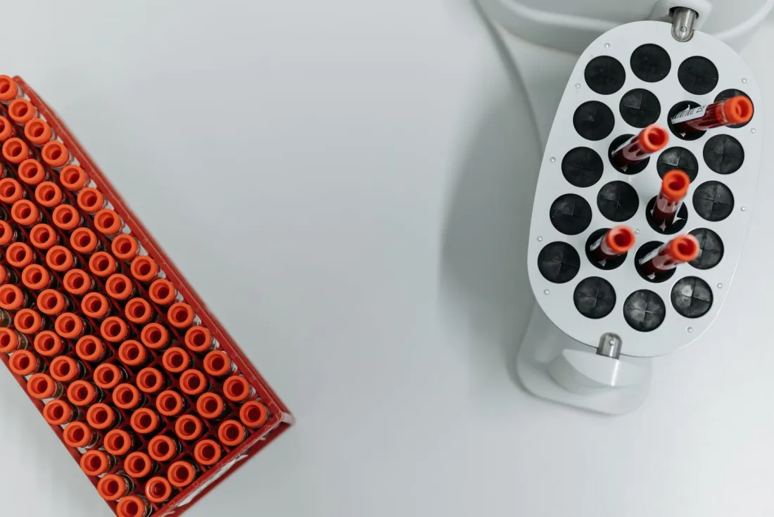 Blood sample tubes in a laboratory centrifuge, illustrating the Athlete Biological Passport evidence behind the Koki Ikeda doping ban